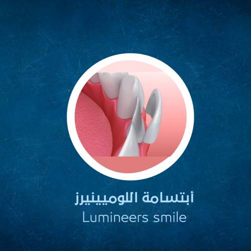 The Lumineers Smile