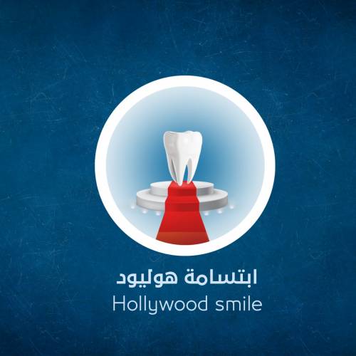 Hollywood Smile