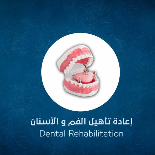 Dental Rehabilitation