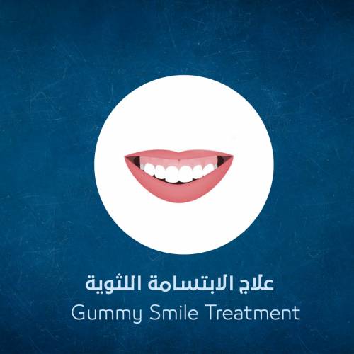 Gummy Smile