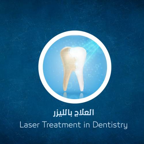 Laser Treatment 