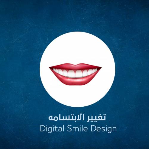 Changing the smile