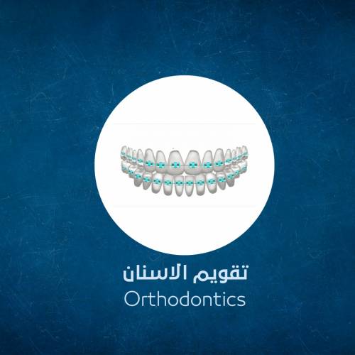 Orthodontic Treatment