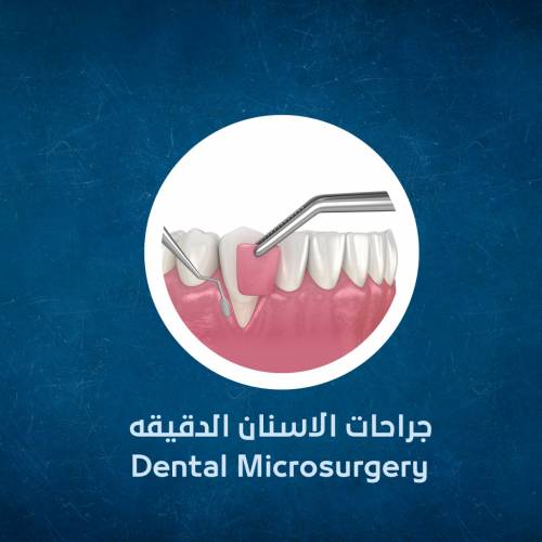 Dental Microsurgeries