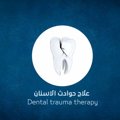 Dental accidents treatment